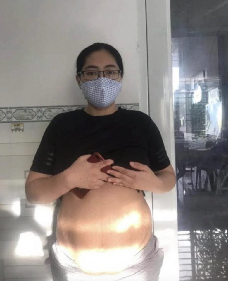 Mỹ nhân Việt tự tin vén áo, khoe &#34;dấu vết sinh nở&#34; khó xóa nhòa - 5
