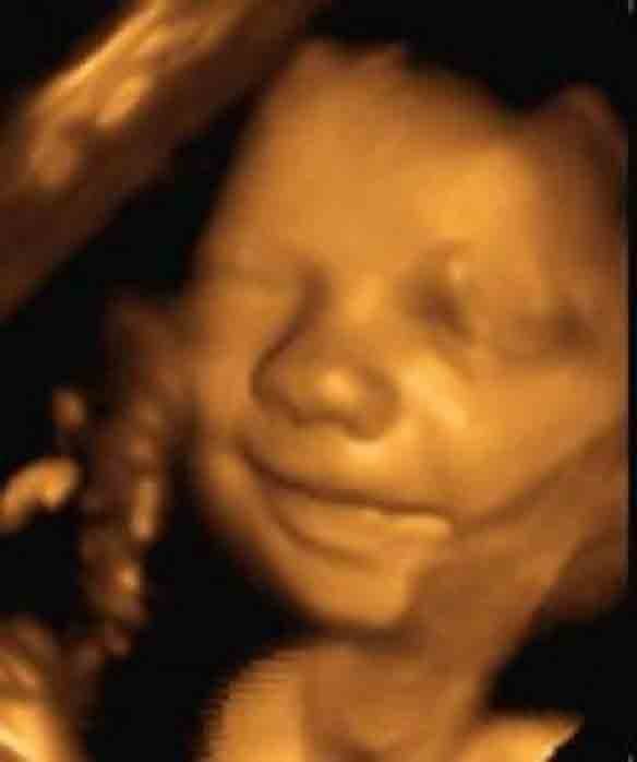 Cử chỉ chưa từng thấy của thai nhi trong lúc siêu âm khiến bố mẹ giật mình - 3