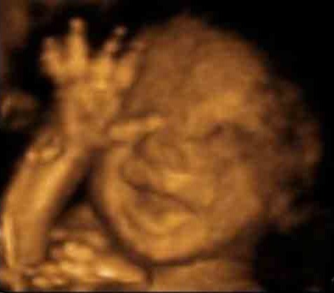Cử chỉ chưa từng thấy của thai nhi trong lúc siêu âm khiến bố mẹ giật mình - 5