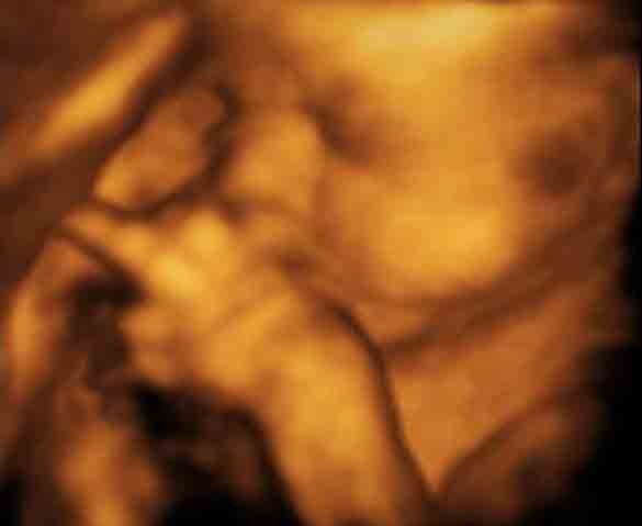 Cử chỉ chưa từng thấy của thai nhi trong lúc siêu âm khiến bố mẹ giật mình - 4