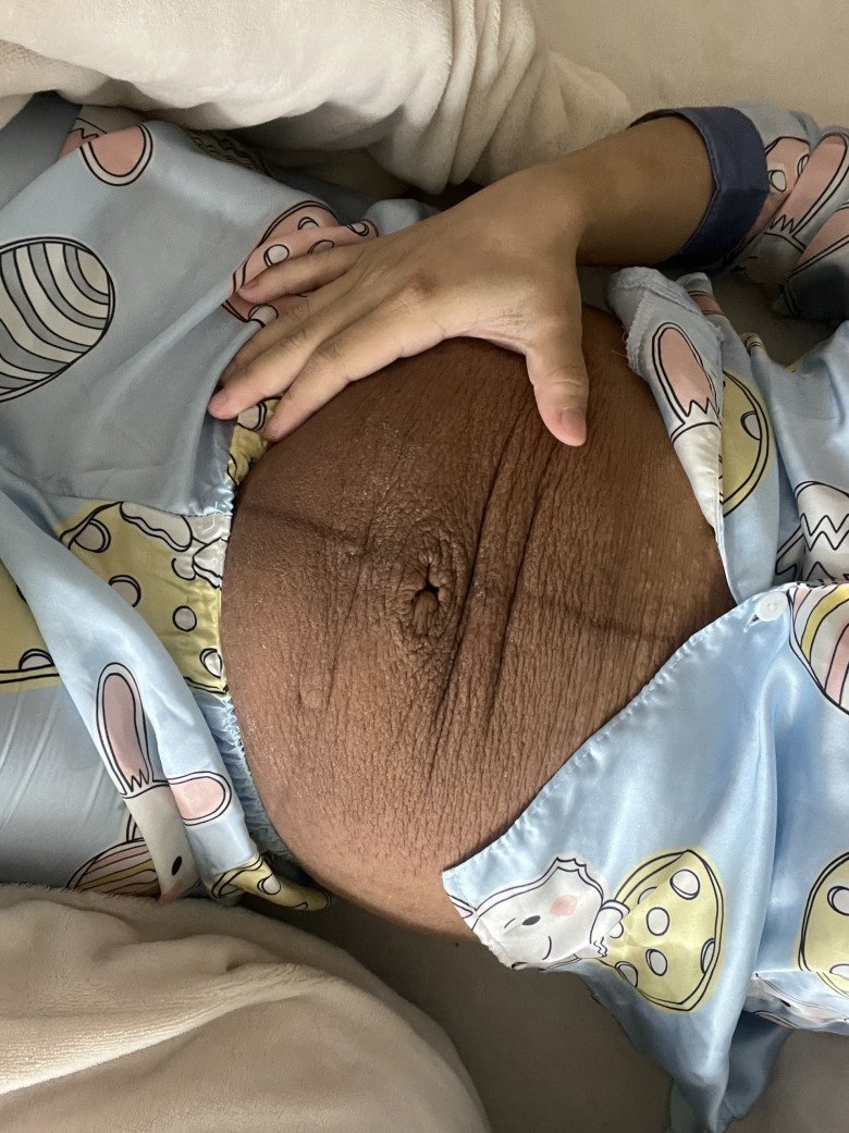 Tưởng bị u nang khó có con, ai ngờ đi siêu âm bác sĩ báo tam thai, mẹ 9X lo nhiều hơn mừng - 7