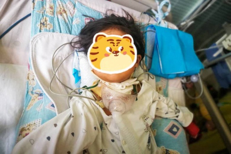 Con làm vỡ nhiệt kế thủy ngân, mẹ sơ cứu sai cách khiến bé nguy kịch - 2