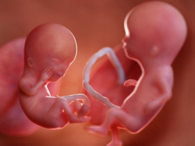 "Vào bụng mẹ" xem tận mắt quá trình phát triển hết sức thú vị của các cặp song sinh