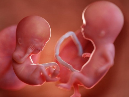 Gia đình - &quot;Vào bụng mẹ&quot; xem tận mắt quá trình phát triển hết sức thú vị của các cặp song sinh