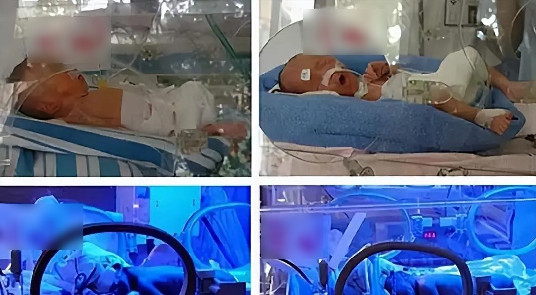 Cuộc sống hiện tại của các bé trong ca sinh tư: 18 năm trước thoát khỏi tử thần, 18 năm sau làm nên kỳ tích - 2