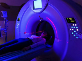 Nghiên cứu mới cảnh báo về nguy cơ ung thư từ máy quét CT