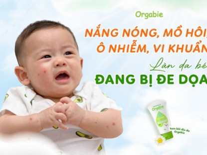 Thông tin doanh nghiệp - Trẻ nhỏ dễ mắc bệnh ngoài da mùa hè – làm sao bảo vệ con yêu?