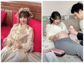 Bị miệt thị sẽ sinh ra "quái thai", mẹ bầu trẻ không tay vẫn được chồng chiều như bà hoàng