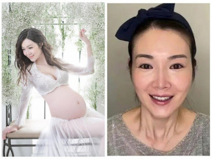 Gia đình - Hoa hậu mặt xinh nhờ dao kéo xuống sắc sau khi sinh 3 con, quyết tâm &quot;trùng tu&quot; lại nhan sắc