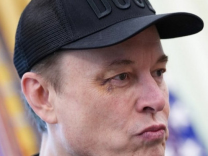 Thế giới - Tỷ phú Elon Musk kể về cú đấm gây bầm tím ở mắt