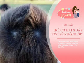 Trẻ có hai xoáy trên đầu sẽ khó nuôi? Nghiên cứu khoa học tiết lộ sự thật