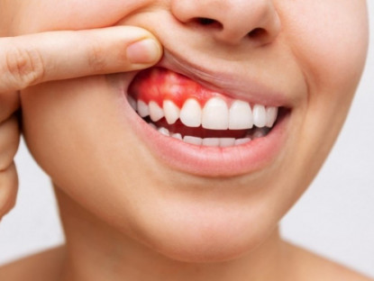 Thông tin doanh nghiệp - Sức khỏe răng miệng – Nền tảng của cơ thể khỏe mạnh