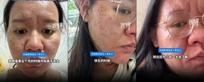 Mẹ bầu trẻ trung xinh đẹp bỗng hóa “bà già” trong 3 tháng cuối thai kỳ - 2
