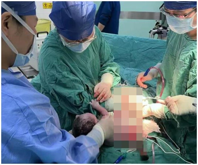 Khoảnh khắc hiếm: Hành động của em bé khi vừa chào đời khiến bác sĩ rưng rưng - 1