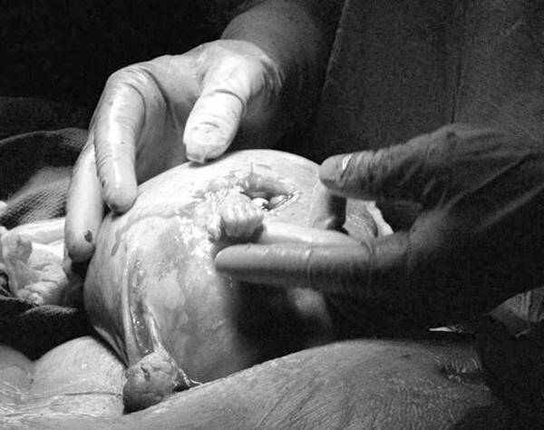 Khoảnh khắc hiếm: Hành động của em bé khi vừa chào đời khiến bác sĩ rưng rưng - 3