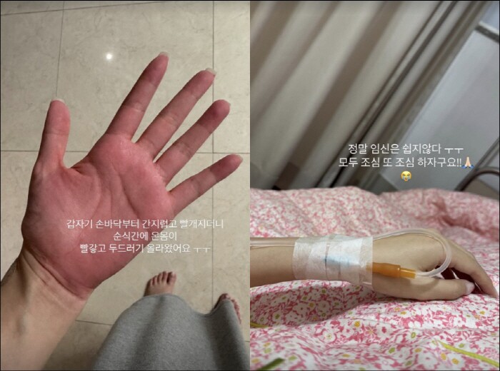 Nữ ca sĩ phải cấp cứu vì sốc thuốc khi đang bầu song thai, hình ảnh ghi lại trong phòng bệnh khiến nhiều người xót xa - 3