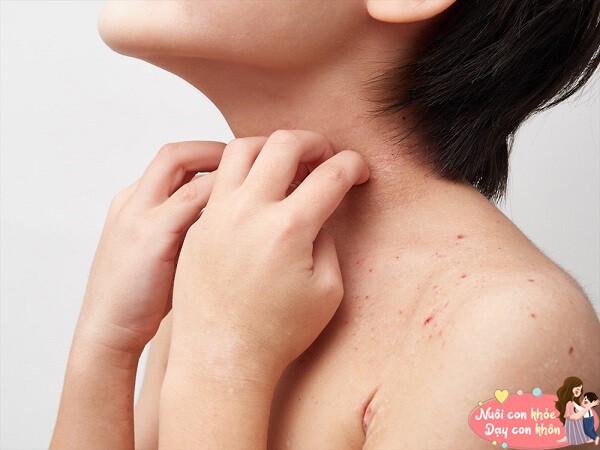 Cẩm nang giải mã những cơn đau bụng của trẻ, không phải con cứ khóc là đói - 4