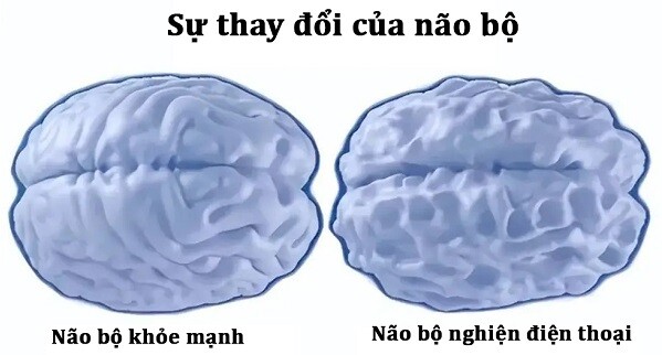 Não bộ trẻ &#34;nghiện&#34; điện thoại và trẻ không chơi điện thoại âm thầm thay đổi, khác biệt lớn sau 10 năm - 5