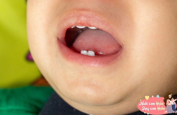 Thói quen xấu khi ngủ của trẻ bị phớt lờ, sẽ âm thầm &#34;làm hỏng&#34; ngoại hình và giảm chỉ số IQ - 6