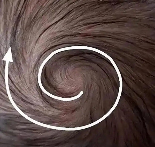 Trẻ có hai xoáy trên đầu sẽ khó nuôi? Nghiên cứu khoa học tiết lộ sự thật - 3