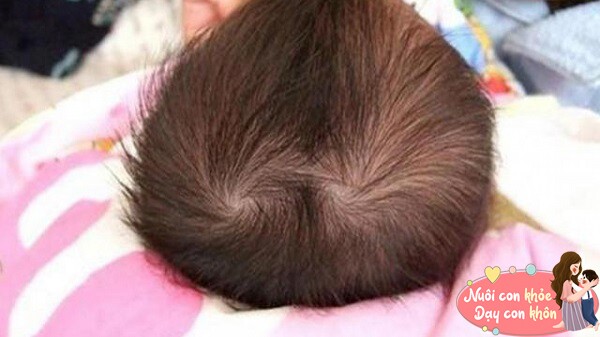 Em bé có nhiều xoáy tóc thì càng thông minh? Khoa học đưa ra giải thích rõ ràng - 5