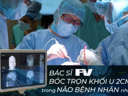 Thông tin doanh nghiệp - Bác sĩ FV bóc trọn khối u 2cm trong não bệnh nhân nhờ công nghệ định vị Navigation thế hệ mới