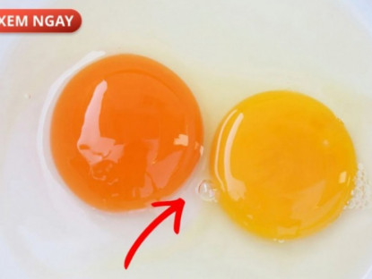 Thông tin doanh nghiệp - 4 món ăn quen thuộc “nuôi lớn” tuyến tiền liệt từng ngày – nhiều nam giới vẫn vô tư ăn mỗi ngày