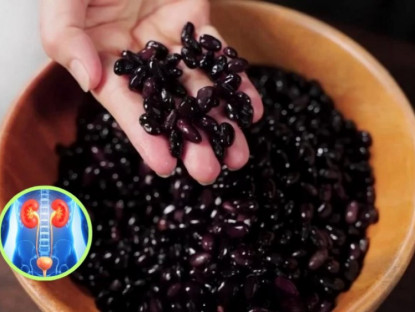 Thông tin doanh nghiệp - Loại nước chưa tới 10.000đ giúp hỗ trợ hệ tiết niệu: Bí quyết khỏe từ trong ra ngoài