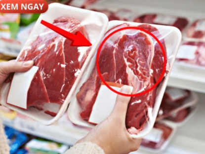 Thông tin doanh nghiệp - 5 loại thực phẩm cực hại cho tuyến tiền liệt của phái mạnh, nhiều người vẫn vô tư ăn mỗi ngày