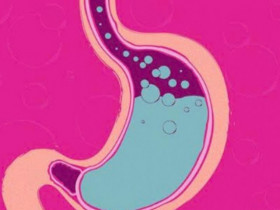 Trào ngược dạ dày nguy hiểm ra sao nếu không hiểu rõ nguyên nhân và xử lý nhanh chóng?