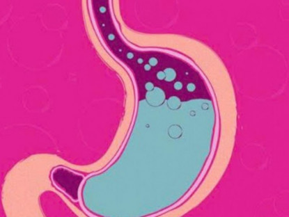 Thông tin doanh nghiệp - Trào ngược dạ dày nguy hiểm ra sao nếu không hiểu rõ nguyên nhân và xử lý nhanh chóng?