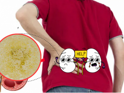 Thông tin doanh nghiệp - 6 dấu hiệu bất thường khi đi tiểu: Cảnh báo bệnh lý tiết niệu nguy hiểm đừng ngó lơ!