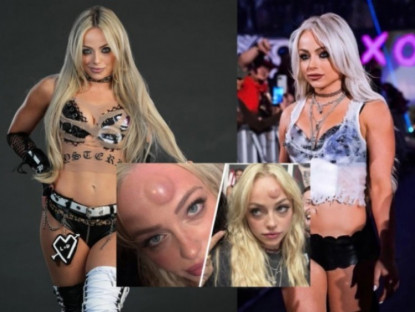 Thể thao - Mỹ nhân vật hết trận vẫn bị tấn công đáng sợ: Vỡ đầu, chấn động não