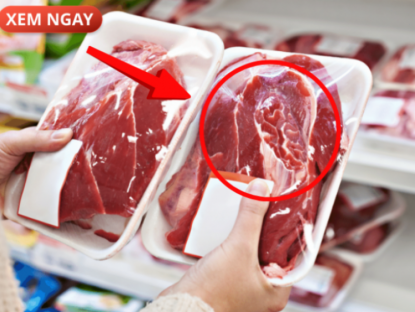 Thông tin doanh nghiệp - 5 loại thực phẩm cực hại cho tuyến tiền liệt của phái mạnh, nhiều người vẫn vô tư ăn mỗi ngày