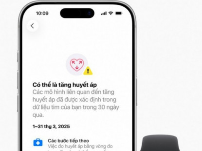Thông tin doanh nghiệp - Apple Watch đo huyết áp có chính xác không? Sự thật cần biết