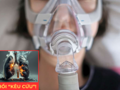 Thông tin doanh nghiệp - 4 yếu tố khiến phổi dễ bị tổn thương khiến đàm ho dai dẳng, khó thở kéo dài