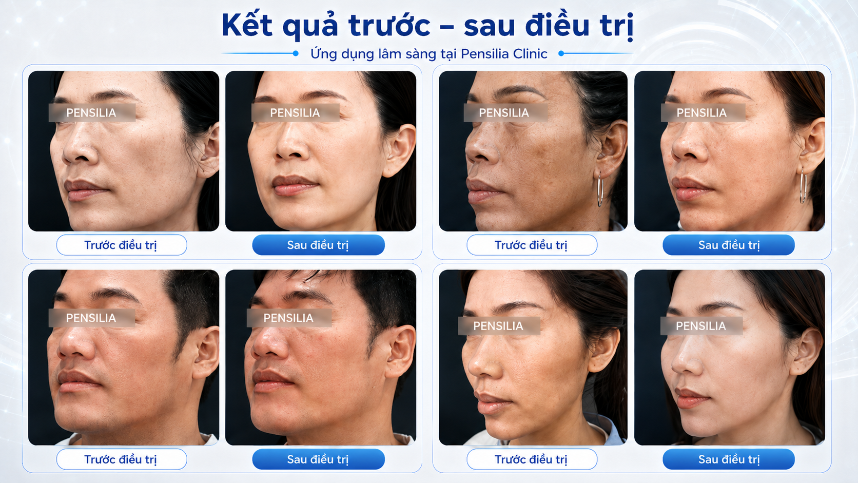 Chiến lược đa phương thức trong điều trị nám được chia sẻ tại Hội nghị Da liễu TP.HCM 2026 - 6