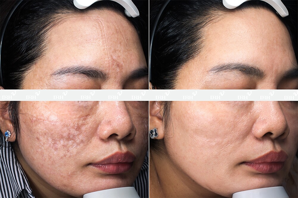 DRH Clinic Gò Vấp – chuẩn mực mới phục hồi da biến chứng tại TP.HCM - 5