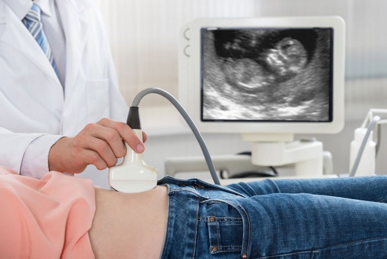 Mẹ khám thai đầy đủ vẫn sinh con dị tật, những vấn đề nào của thai nhi siêu âm không thể phát hiện? - 3