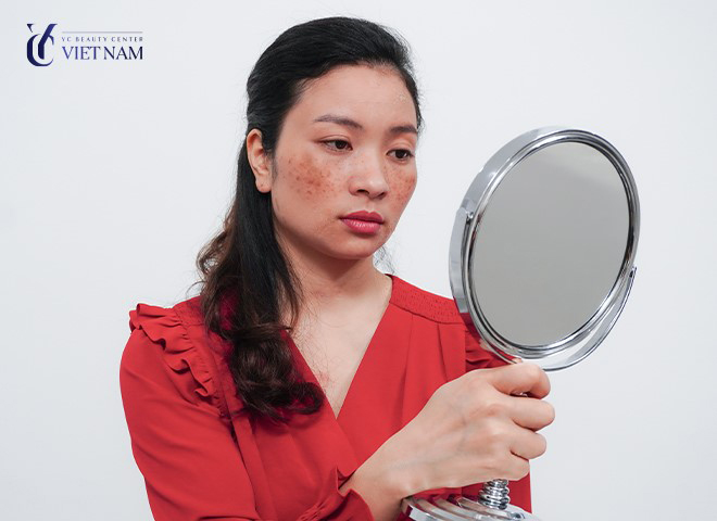 Công nghệ trị nám Nanocell Melasma tại Phòng khám Da liễu Quốc tế YC có ưu điểm vượt trội gì? - 1