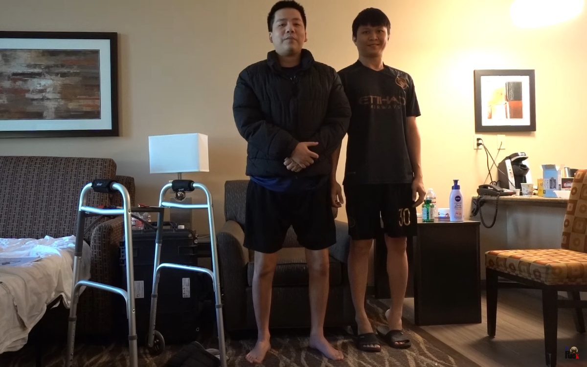Tình hình Khoa Pug sau 1 tháng &#34;biệt tăm&#34; vì kéo dài chân lên 1m75 - 4