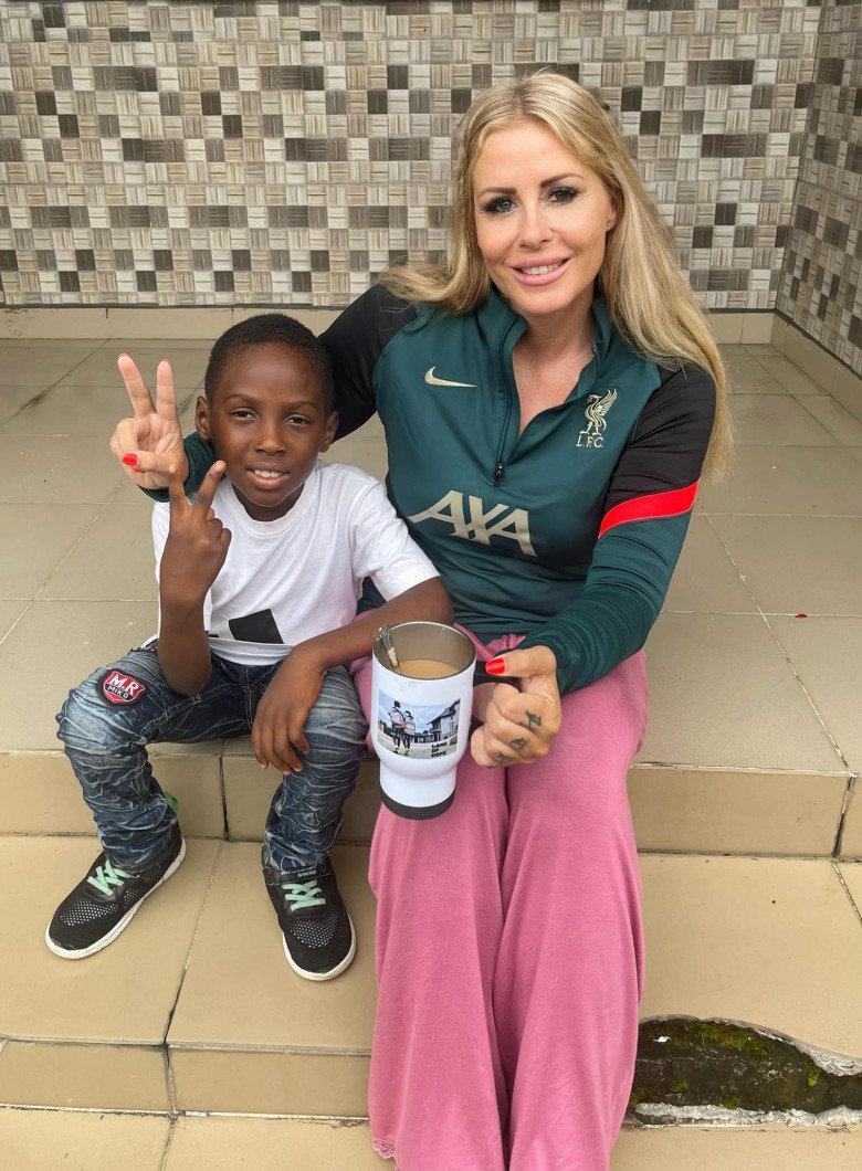 Hình ảnh đẹp trai bụ bẫm của cậu bé châu Phi suy dinh dưỡng từng làm thế giới xót xa - 5