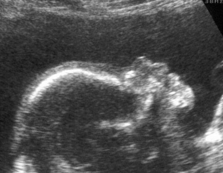 Những thai phụ bị chết não, sống nhờ thở máy vẫn kiên cường sinh con khỏe mạnh - 4