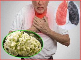 Mùi hoa sữa - mối hiểm họa với người bệnh hen suyễn