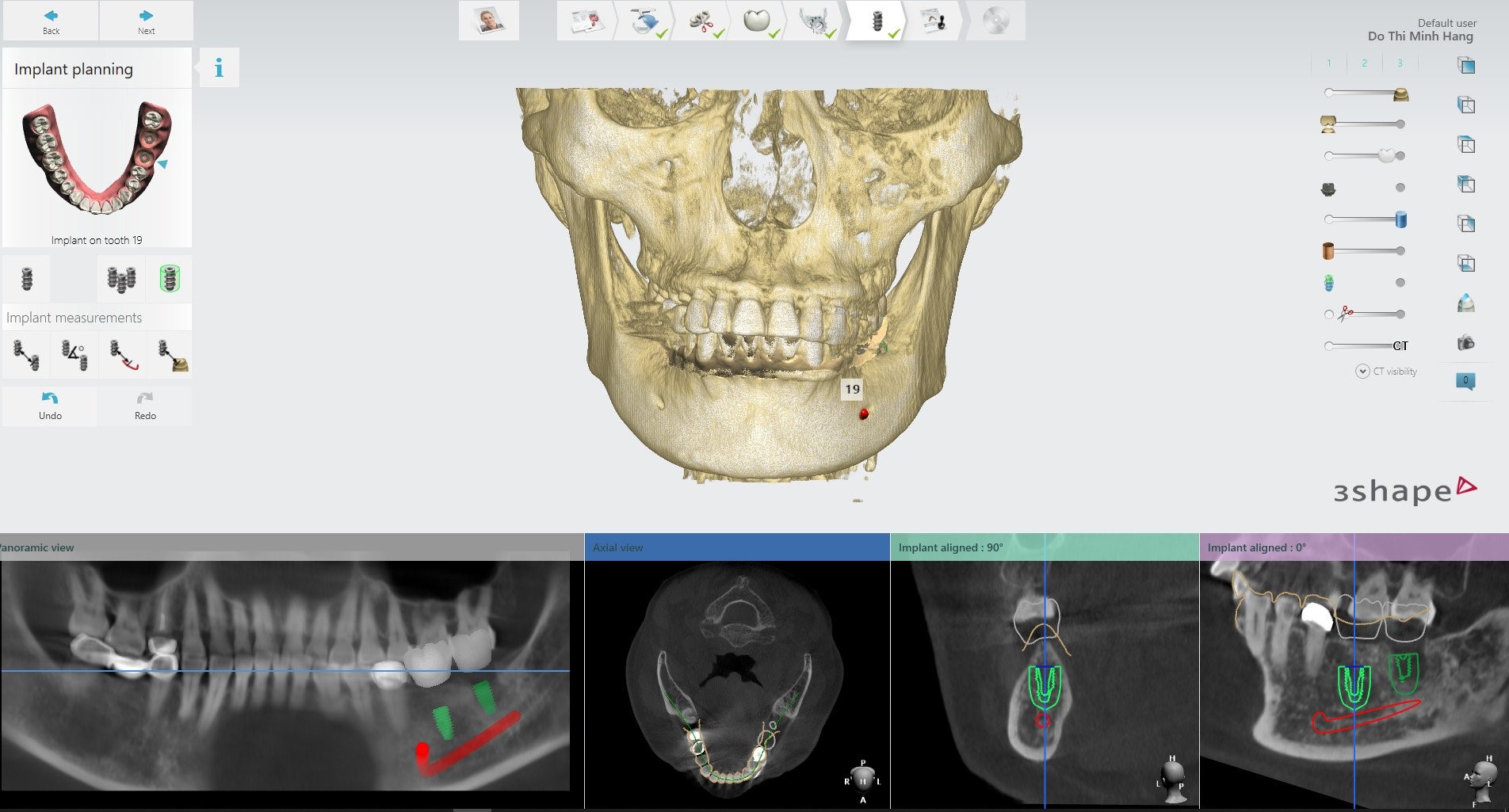 Tọa đàm “Ưu điểm của công nghệ trồng răng implant Safe-tech” - bước tiến mới trong ngành nha khoa thế giới - 2