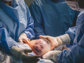 Hà Nội: Em bé sơ sinh chào đời trong túi ối còn nguyên, sản phụ có nên thử đẻ “bọc điều”?
