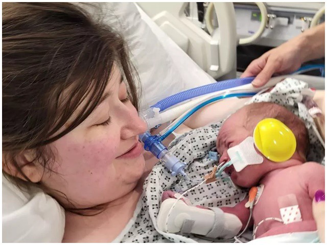 Phớt lờ cơn đau đầu tưởng đơn giản, bà bầu suýt mất mạng cả mẹ và thai nhi - 1