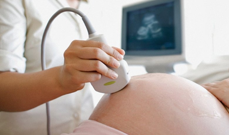 9 tháng mang thai và đi đẻ tiết kiệm nhất, mẹ bầu cũng tốn 33 triệu đồng và những lưu ý thiết thực - 2