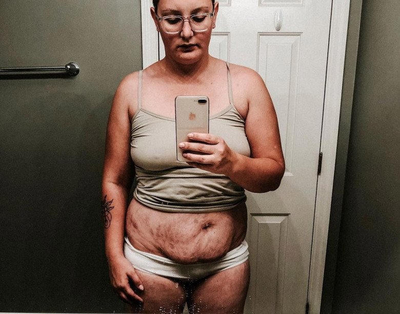 Người mẹ đăng ảnh bụng sau 10 lần mang thai "gây bão" MXH, lý do vì đâu? - 1