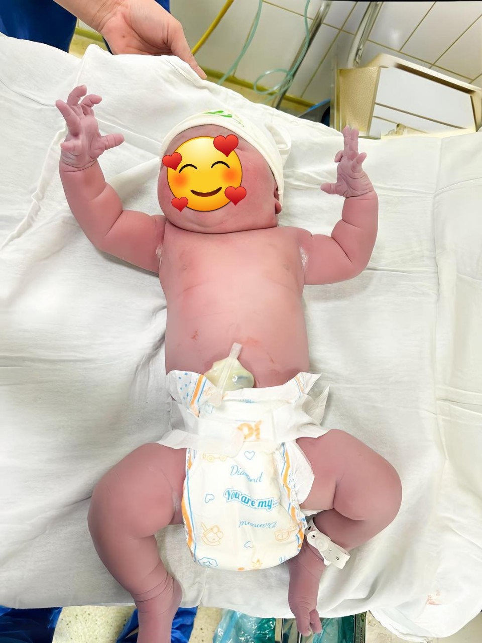 Bé gái sơ sinh nặng 5kg chào đời khỏe mạnh, được mẹ bầu “xin vía” vì quá bụ bẫm - 2